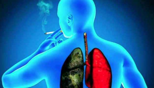 Este es el daño que causa al pulmón fumar menos de 5 cigarrillos
