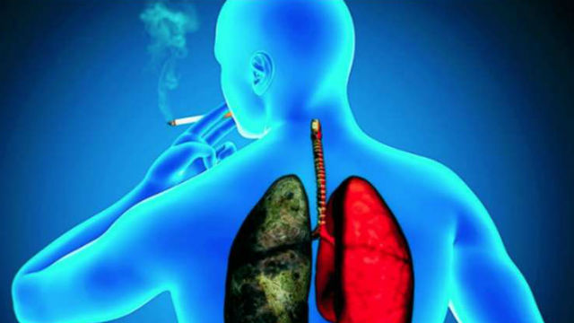 Mortalidad de cáncer de pulmón superará la de mama este año en Europa