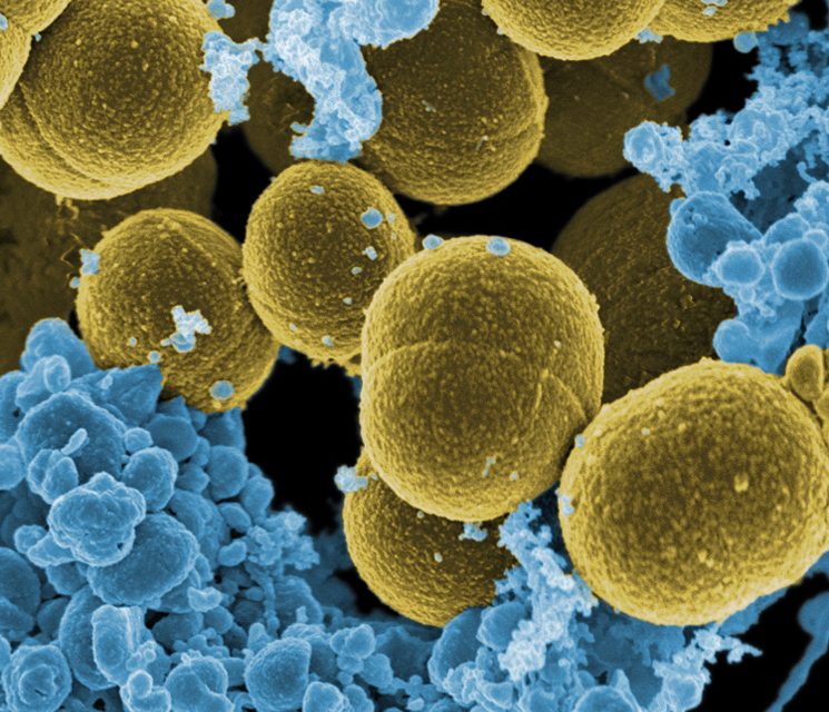 Descubren que un compuesto del cannabis puede ser útil en la lucha contra las superbacterias