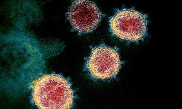 La nueva pandemia de coronavirus ha afectado a los ensayos que están evaluando vacunas preventivas frente al VIH