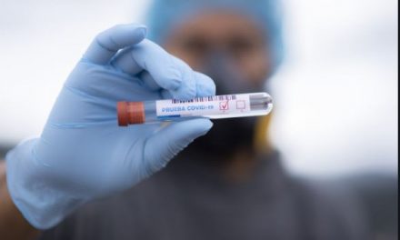 La realización conjunta de pruebas de COVID-19 y de VIH podría ayudar a frenar la propagación de las dos infecciones