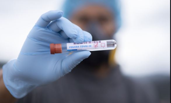 La realización conjunta de pruebas de COVID-19 y de VIH podría ayudar a frenar la propagación de las dos infecciones
