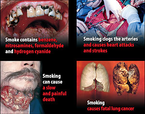 Las imágenes que verán los británicos en todas las cajetillas de tabaco