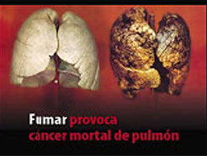 Las imágenes de advertencia llegan a las cajetillas de tabaco españolas
