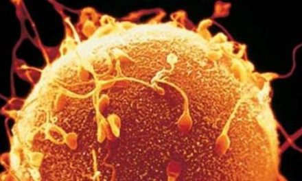 Fumar cannabis puede afectar al tamaño y la forma de los espermatozoides de los jóvenes