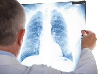 Enfermedad Pulmonar Obstructiva Crónica no sólo daña pulmones