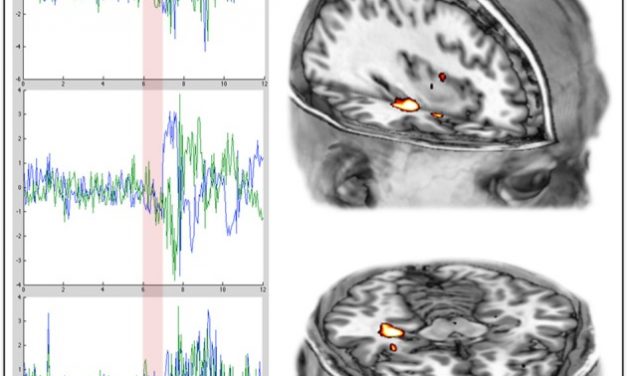 Los hongos alucinógenos provocan el mismo patrón cerebral que los sueños