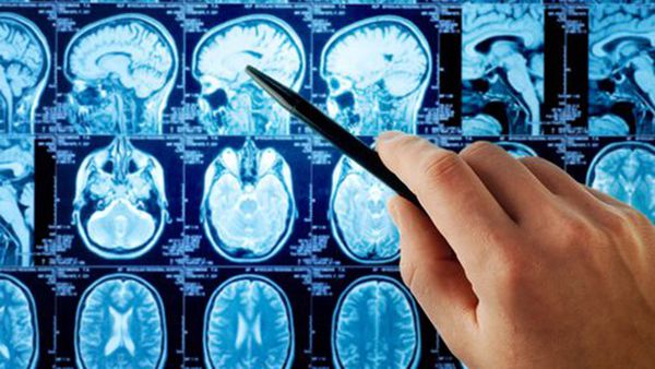 El cerebro adicto: cómo las drogas anulan las capacidades humanas
