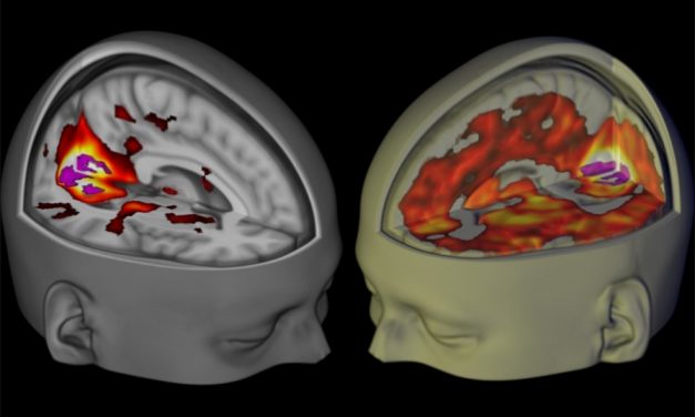 ¿Cómo se ve el cerebro de un consumidor de LSD?