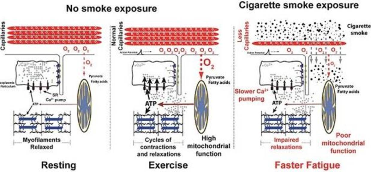 El tabaco causa un daño directo sobre los músculos del cuerpo