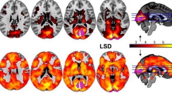 Un plan para aprovechar las drogas psicodélicas contra la depresión o las adicciones