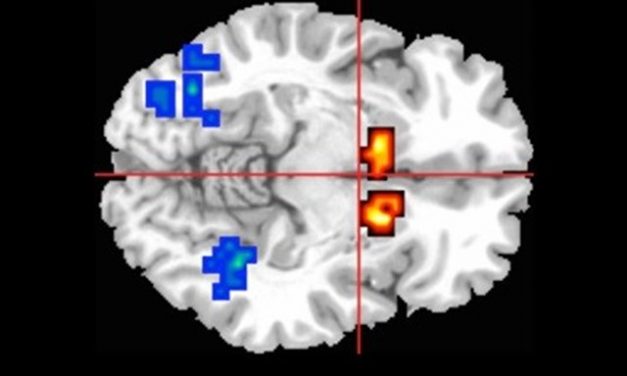 El cannabidiol ayuda a restablecer la función cerebral en la psicosis