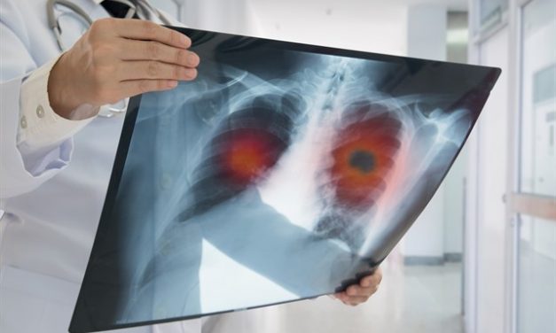 Enfisema pulmonar, el gran desconocido para muchos fumadores
