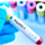 Hepatitis C